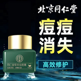 20g TongRenTang Herbal Acne Cream 同仁堂草本祛痘膏20g/瓶 甄选草本原料 补水保湿 滋润柔滑 NEW !