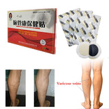 4pcs Spider Veins Varicose Treatment Plaster Varicose Veins Cure Patch Vasculitis Natural Solution Herbal Patches