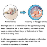 Health Care Silicone Anti Snoring Tongue Retaining Device Snore Solution Sleep Breathing Apnea Night Guard Aid Stop Snore Sleeve